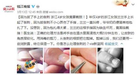 宝宝指甲长倒刺是缺维生素吗？倒刺正确处理法