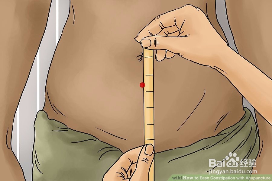 如何用针灸缓解便秘