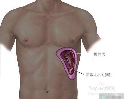 男人体虚怎么办？
