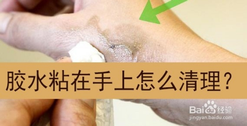 膠水粘在手上怎麼清理?