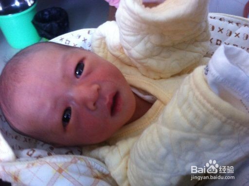 宝宝大腿根部破皮处理办法