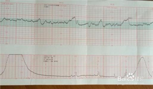 怀孕后期宝宝体重偏小怎么办