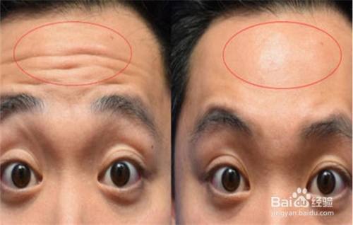 拍按额头和下巴,这两个部位很重要,不可忽视.