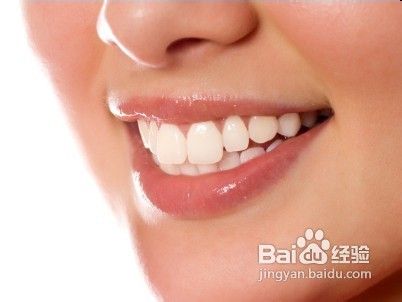 美白牙齿常见的五大误区有哪些？