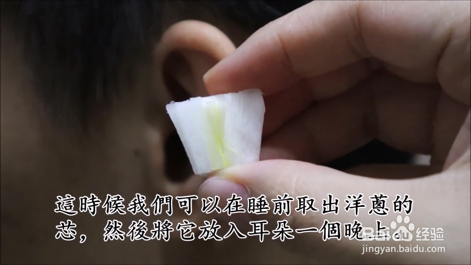 如何缓解耳朵感染？