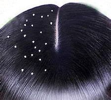 怎么样可以修复受损的头发