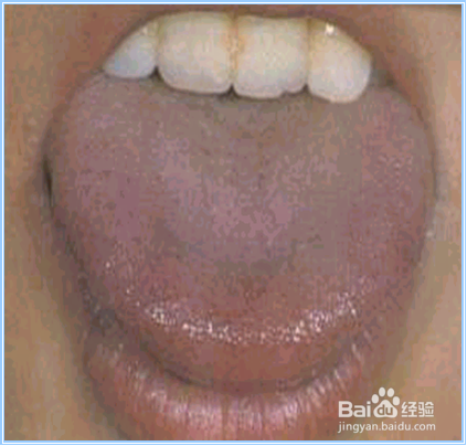 如何诊舌头颜色