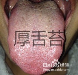 中医胃症有哪几个类型、其主要临床表现是什么