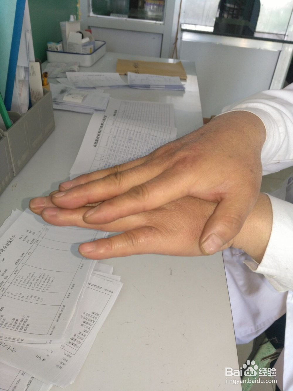 拍手也能养生,5种拍手方法