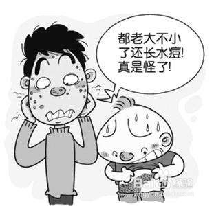 带状疱疹疫苗有必要接种吗?