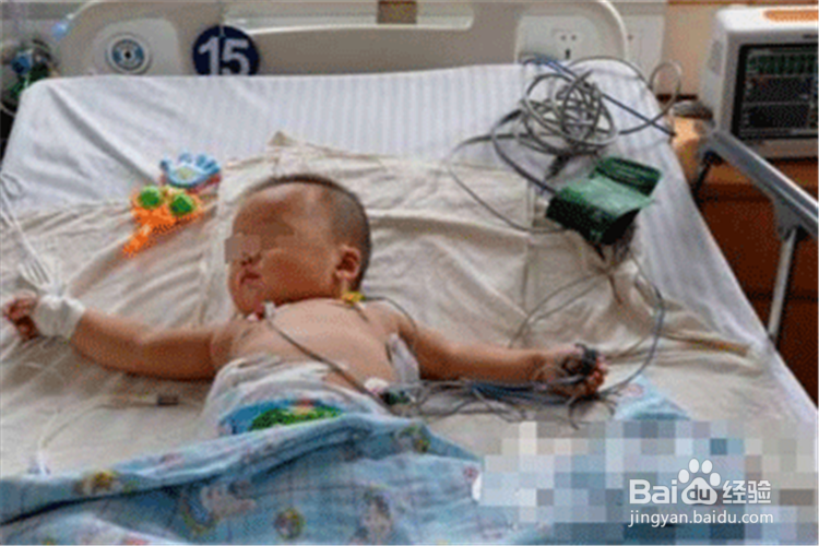 新生儿死亡怎么办