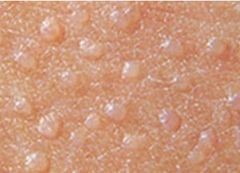 小孩长扁平忧怎么办