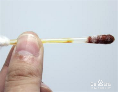 仓鼠打架腿流血了怎么办