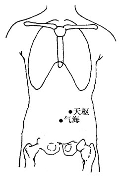 百病刮痧：[20]便秘的刮痧疗法
