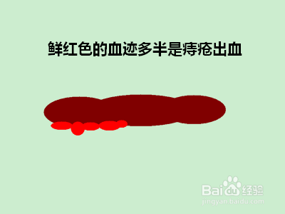 怎样根据大便及早发现健康隐患
