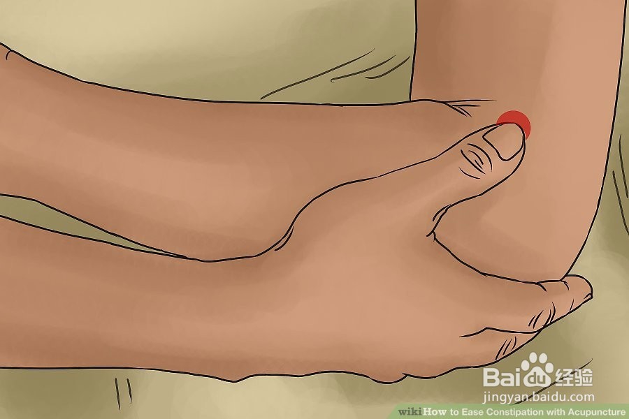 如何用针灸缓解便秘