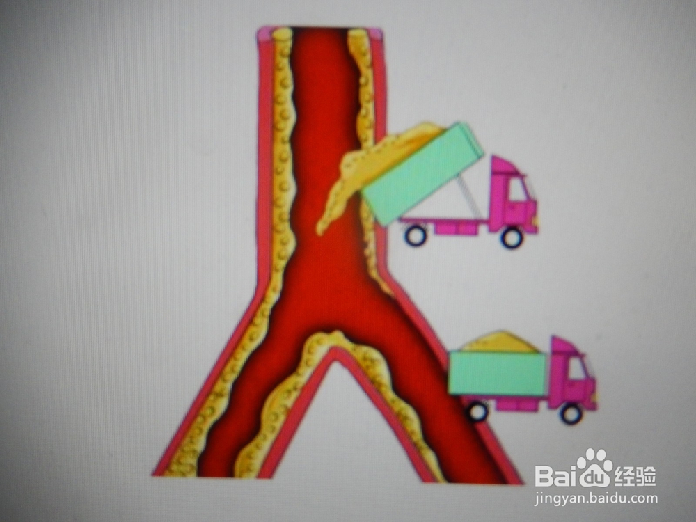 怎么提高血管“年轻化”，防止变老？