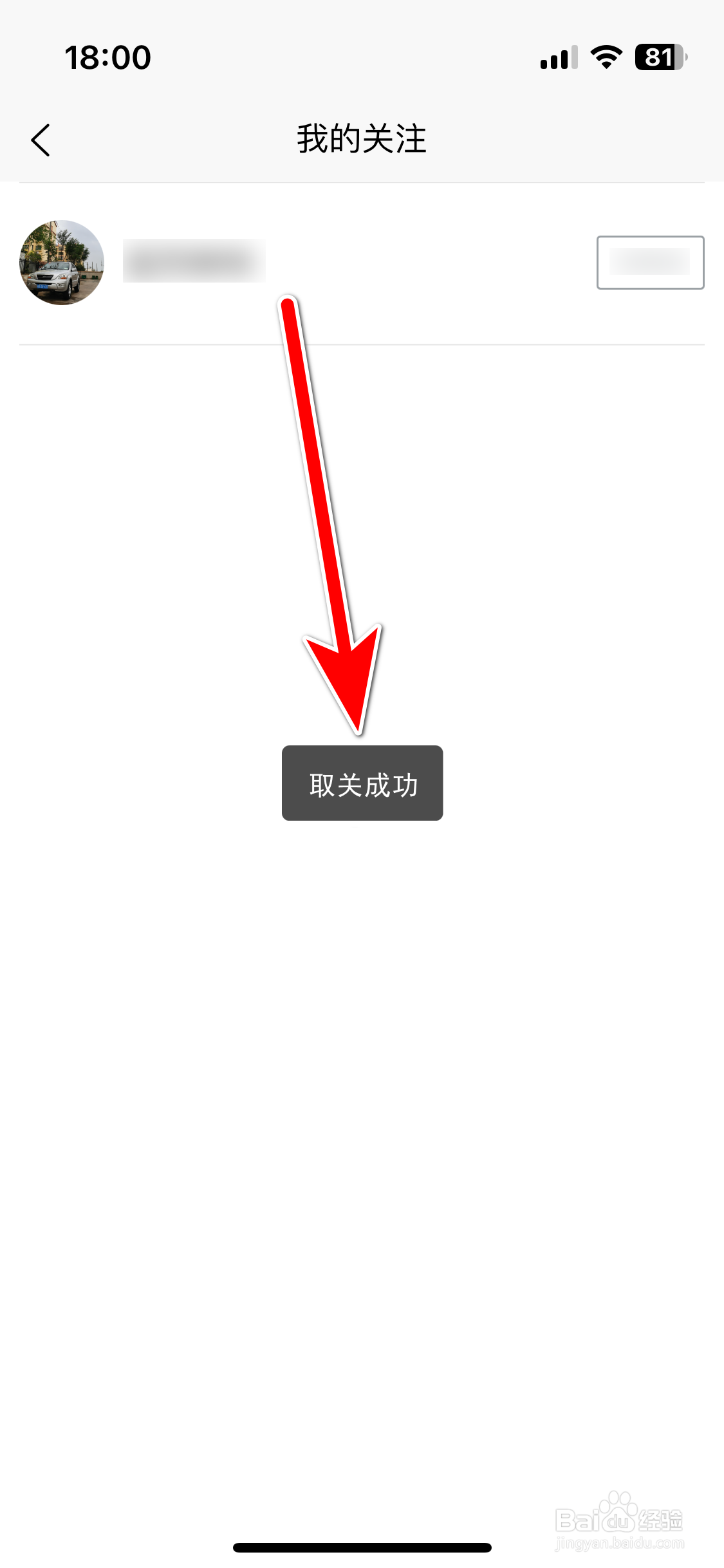 起亚Kia如何取消关注用户