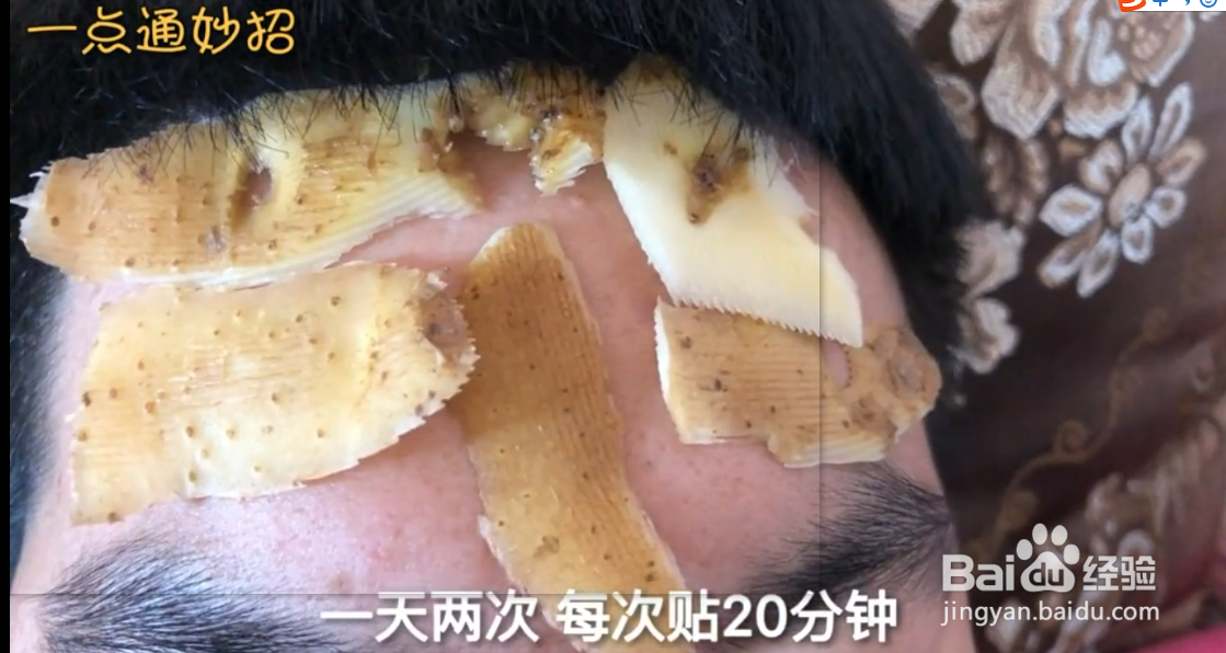 土豆皮的妙用分享