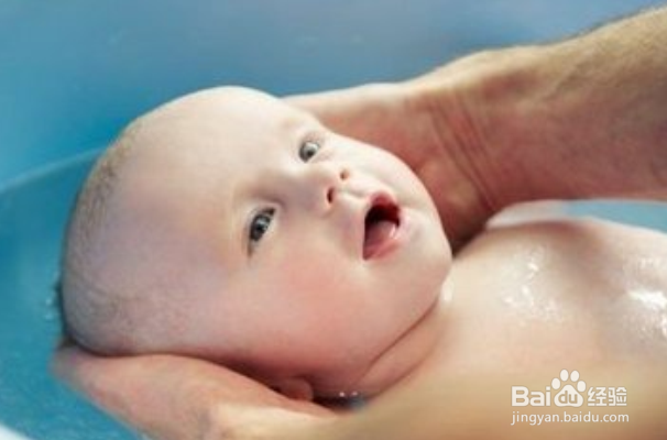 怎么治疗宝宝得的脂溢性皮肤炎