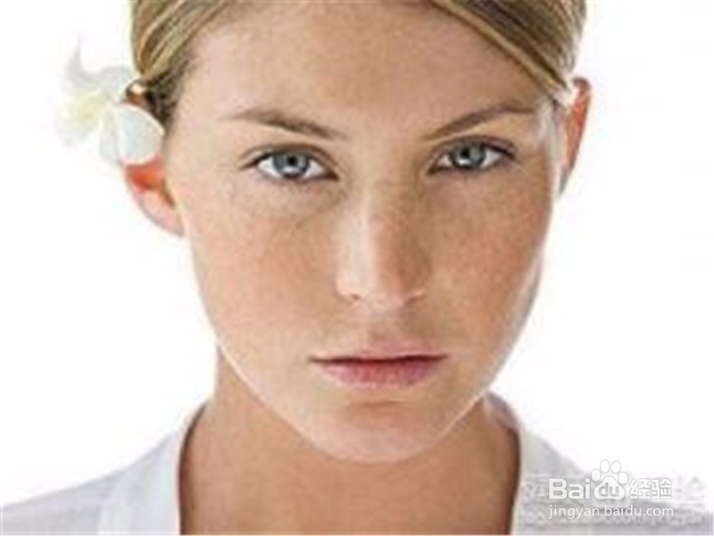 黄褐斑颜色发黄的妹纸祛斑要先补脾