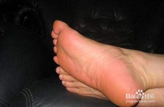 脚上起水泡很痒怎么办？