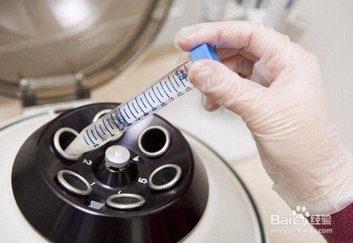 试管婴儿有几种移植方式那种成功率高