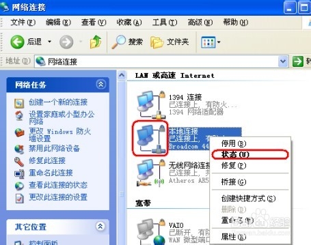 如何查看本地IP地址