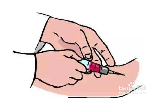 孕妇产假糖筛有哪些步骤