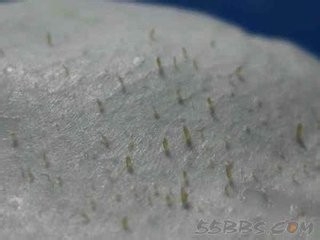 怎么去黑头？我有办法！！