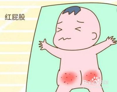 新生宝宝红屁屁怎么护理