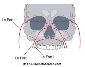 骨折愈合的时间