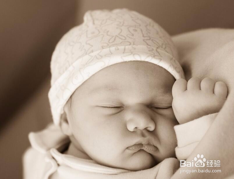 剖腹产后，产妇要注意什么事情？