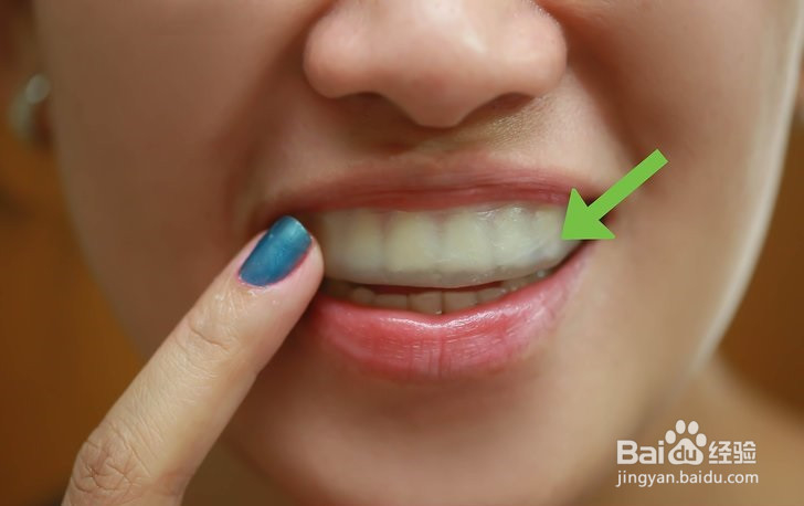 如何不花钱让自己的牙变白?