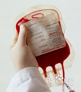 女性养生话题：6种贫血的防与治方法推荐