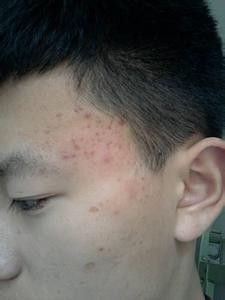 怎么用简单方法解决女性的斑暗黄等肌肤问题呢?