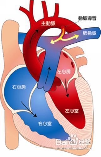 不同先心病患儿的护理方法不同