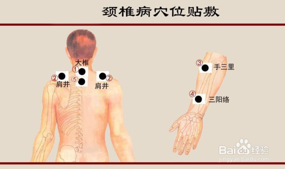 五宗堂黑膏贴敷方法和注意事项