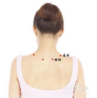 落枕后脖子酸疼怎么办