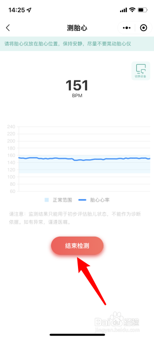 海尔胎心仪怎么连接手机