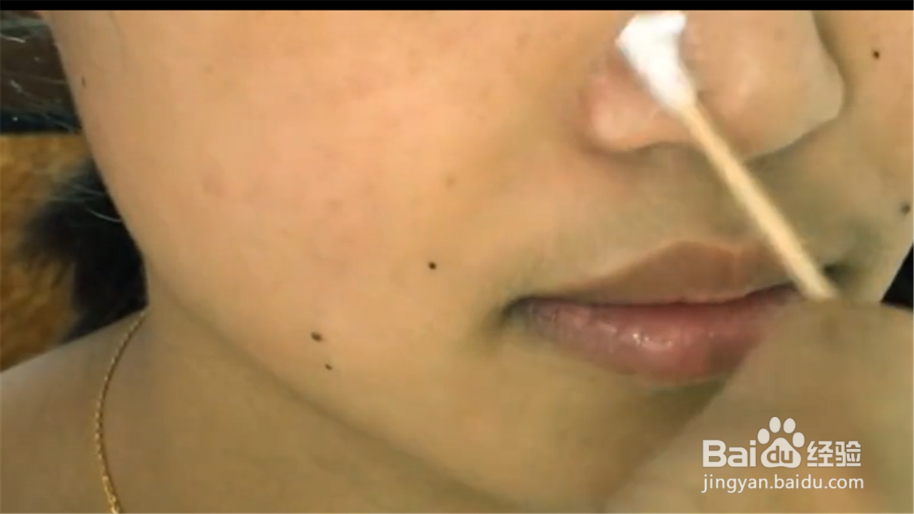 如何妙用阿司匹林