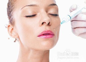 怎样去脖子上的皱纹