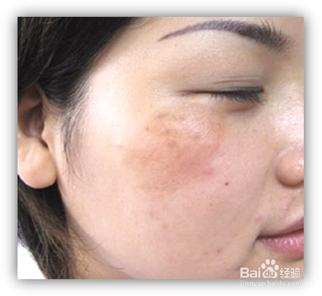 清除身体的宿便，能减肥!!!