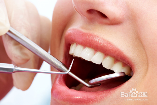 怎样保持自己的口气清新?