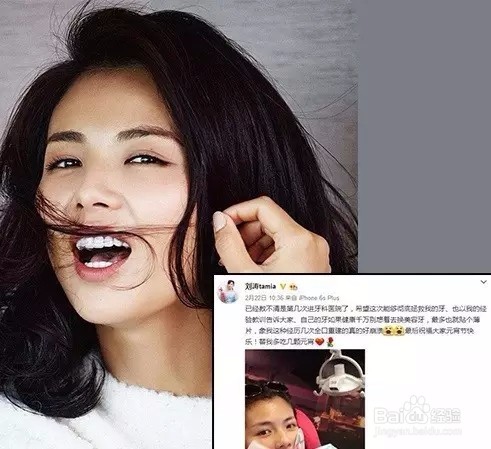 牙齿变白的方法有哪些呢？