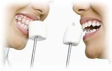 保护牙齿的九个标准是什么