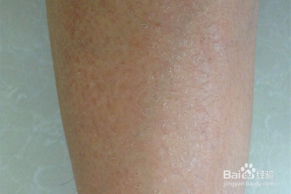 冬季养生需要注意什么?