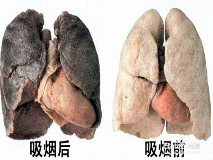 咋样能把烟给戒了