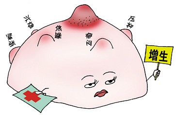 乳腺增生的治疗方法