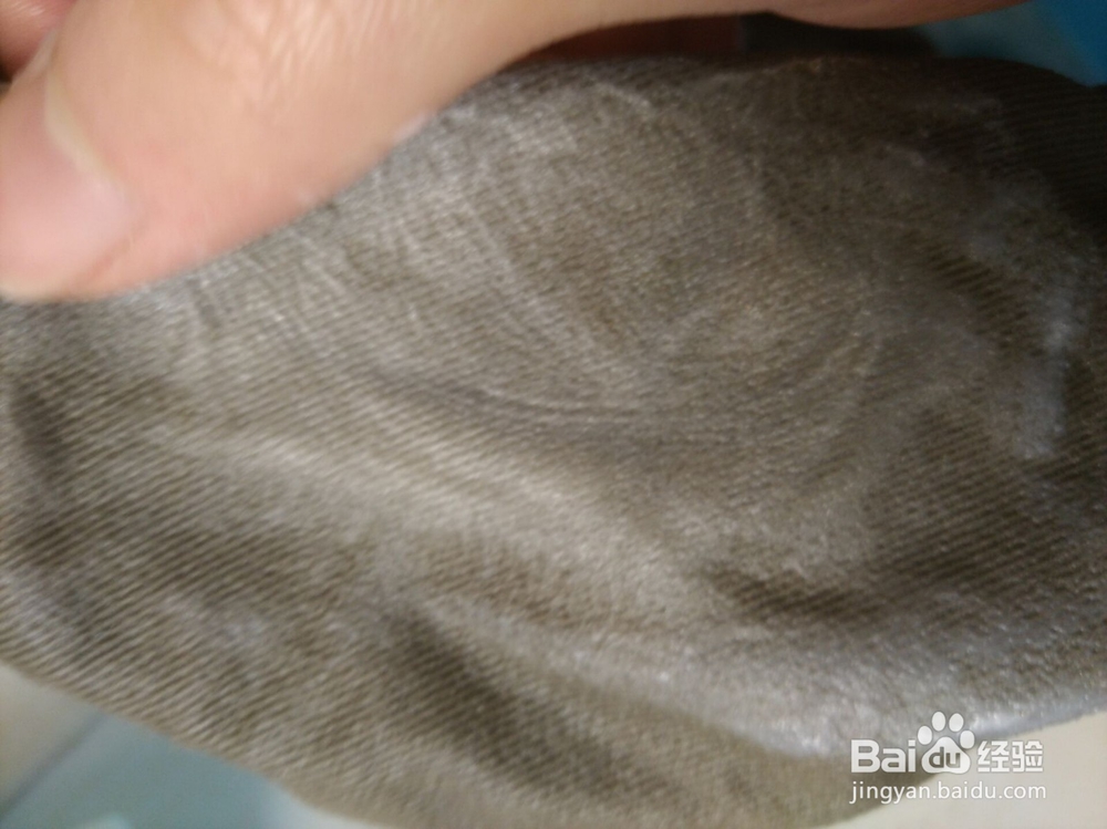 碘酒、碘伏弄到衣服上了怎么办?